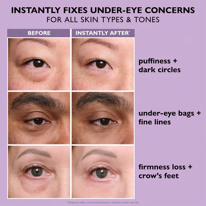 Instant Under-Eye Lift & Smooth Serum